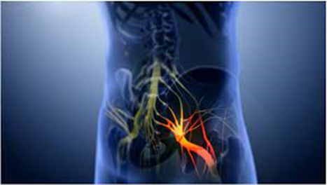 Fascitis plantar y dolor en el talón: causas, síntomas y tratamiento conservador