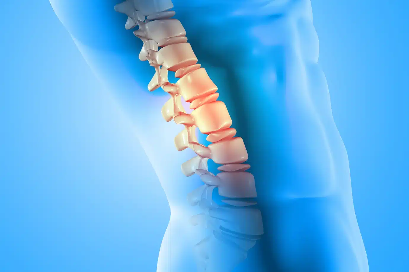 Hernia Discal: El Escudo que se Rompe. Opciones de Tratamiento Antes de Pensar en Cirugía